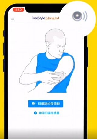 雅培瞬感血糖仪